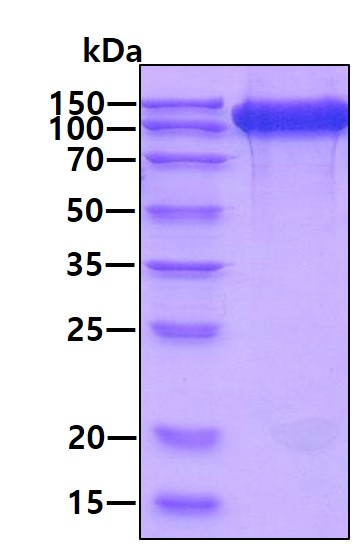3 μg by SDS-PAGE under reducing condition and visualized by coomassie blue stain.